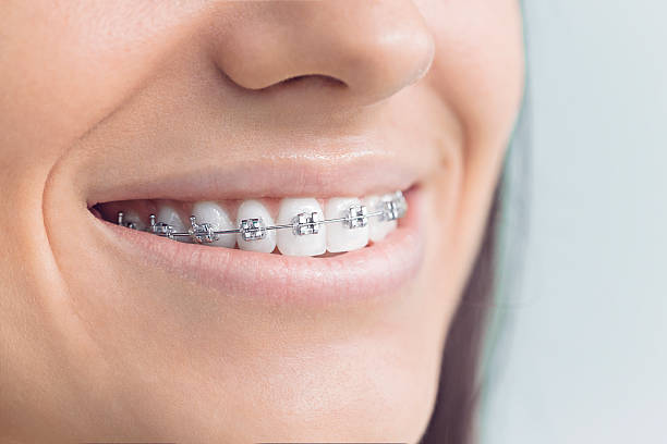 Best Full Mouth Reconstruction  in Sorrento, LA